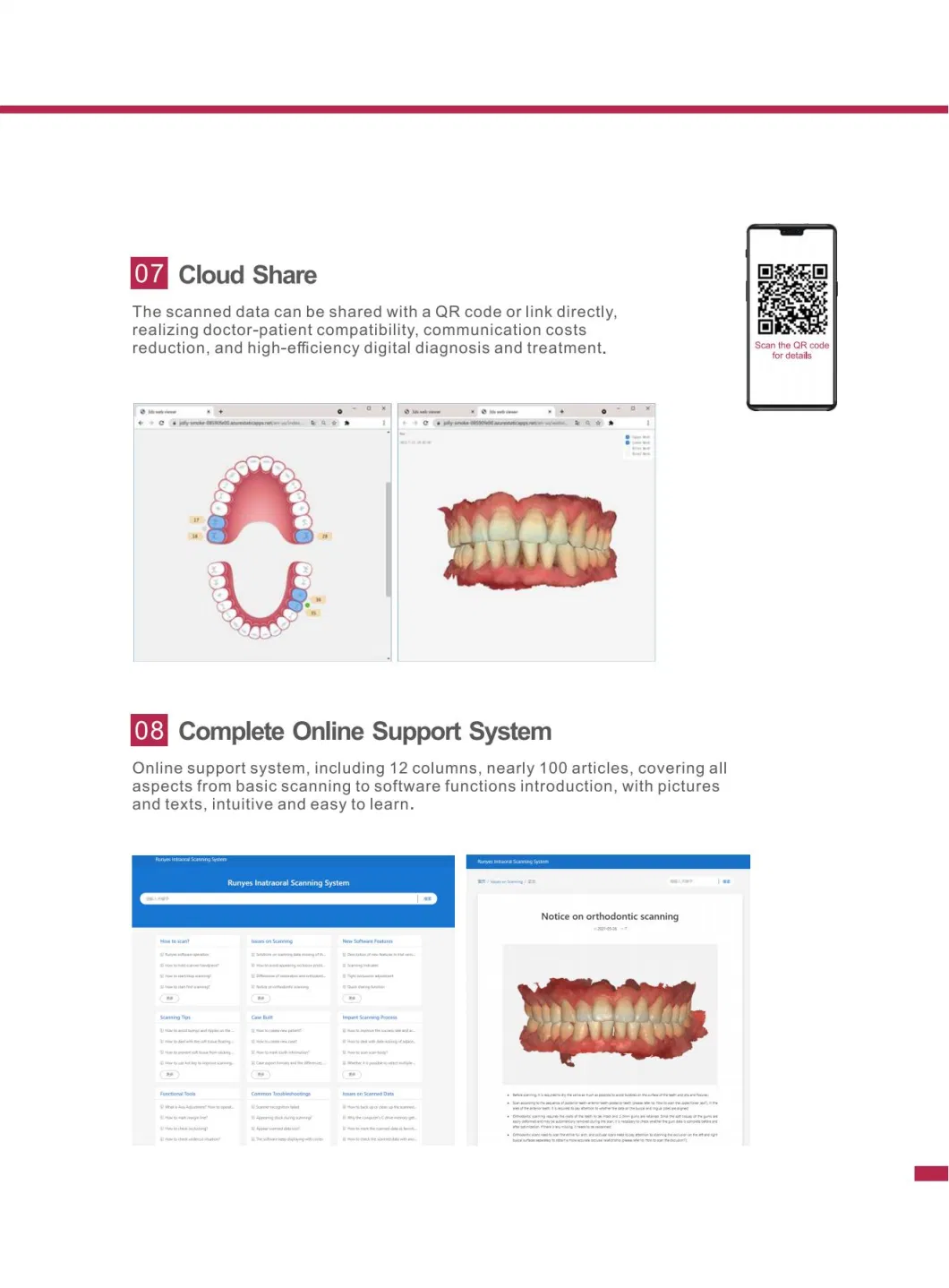 Dental Oral Scanner Digital 3D Scanner for Implant Orthodontics Restoration